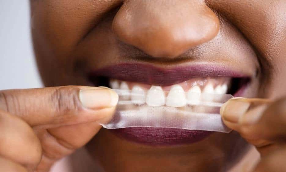 teeth whitening strips